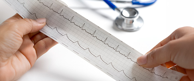 Πλήρης καρδιολογικός έλεγχος Πλήρης καρδιολογικός έλεγχος